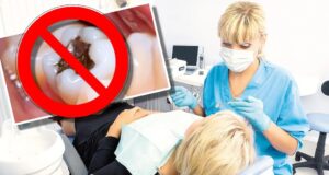 U.E. a decis: plombele dentare interzise începând cu 1 ianuarie 2025